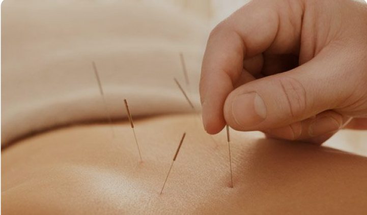 Akupunktur uddannelse