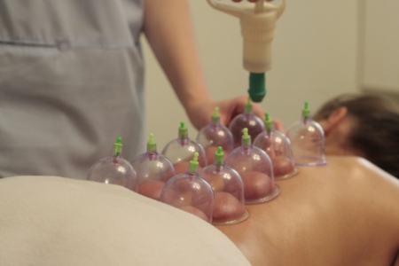 Cupping kursus